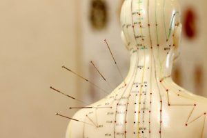 Acupuncture Care in a Multidisciplinary Clinic